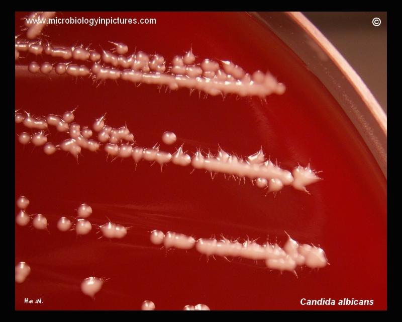smell (odour) Blood Agar PDA - White creamy colored - Foot-like