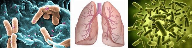 Lung Microbiome What is there?