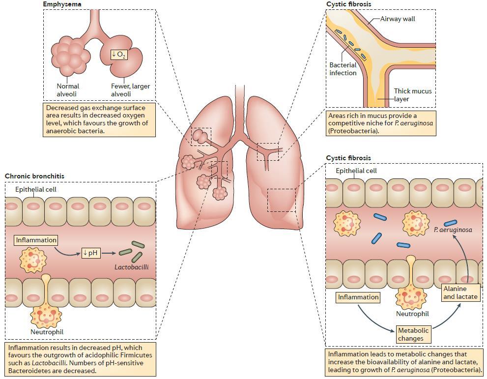 Lung Microbiome: affected by local sites Marsland