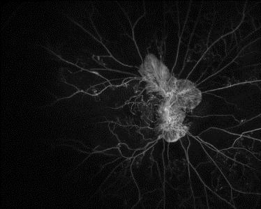 remodeling of vasculature