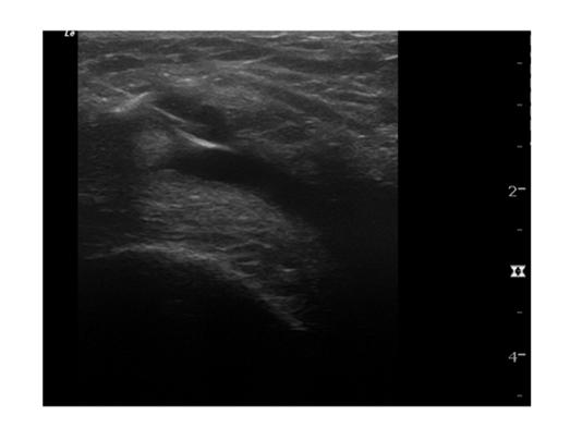 in patient education Ultrasound can