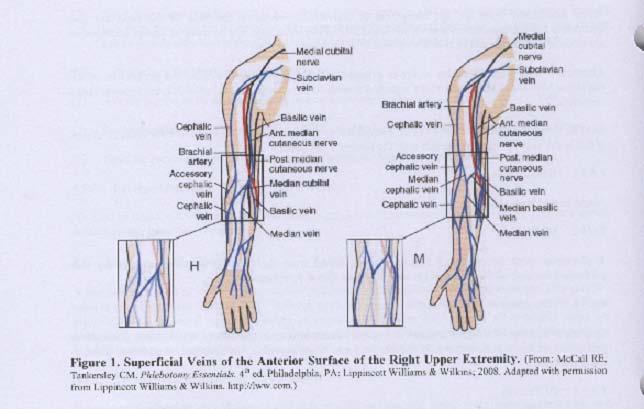 Factors in Vein Selection: Select the vein carefully. The brachial artery and several major nerves pass through the antecubital area.