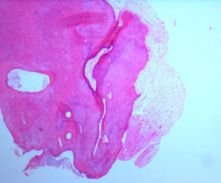 Decalcified hematoxylin & eosin stained section
