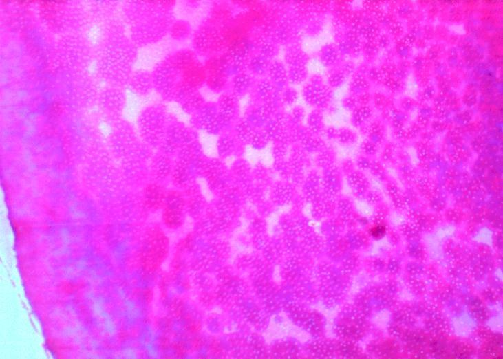 Fig: 5 Hematoxylin and eosin stained sections showing