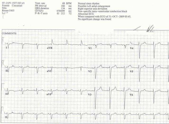 83 y/o, PMH: pulmonary hypertension and