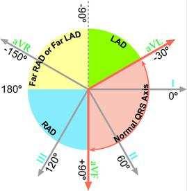 Four Quadrants of Hexaxial System Extreme Right Axis -90 to +180/270 Left Axis Quadrant -30 to - 90 Lead