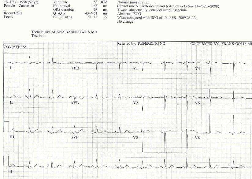 Admission EKG --Troponin bumped to 2.