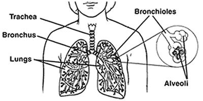 Lung Cancer Most originate in bronchi Can be metastatic