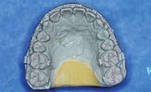position in worn incisors Determine how sustained occlusal forces affect masticatory function.