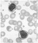 Eosinophils phagocytosis, eukaryotic pathogens, inflammation & allergy Agranulocytes (very small granules) T