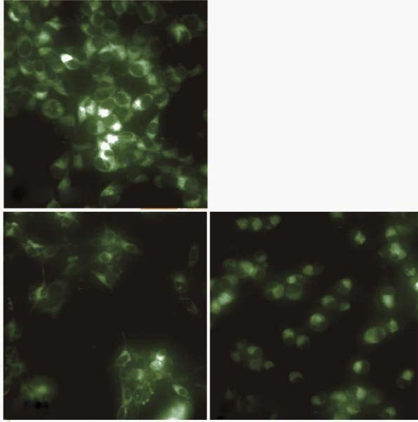 Mori S et al. PPI induces-collagen expression in colonocytes A 200 B 150 b b b b 150 b 100 4HNE (%) 100 50 4HNE (%) 50 0 Glc 0 100 450 0 100 450 PPI 0 Glc 0 100 450 0 100 450 ph8.