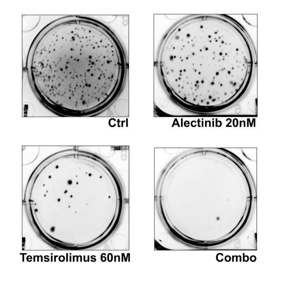 Hit two different targets: In vitro experiments Proliferation assay Selection of resistant cell