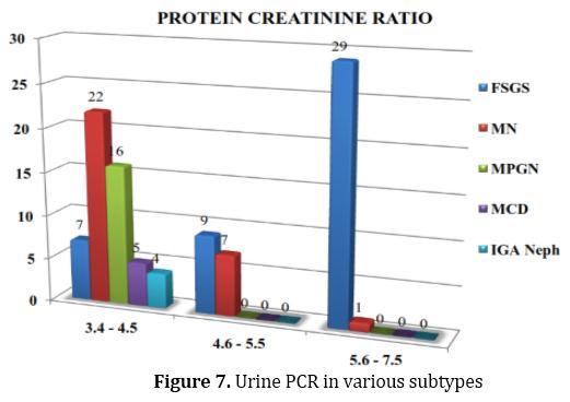 Proteinuria was quantified using urine protein creatinine ratio, and it was observed that a significant amount of protein loss was