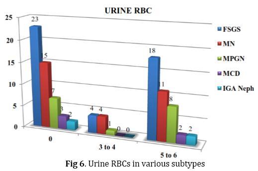Urine routine showed proteinuria which was later quantified by urine protein creatinine ratio, urine routine also showed hematuria which was significantly observed in IgA nephropathy and
