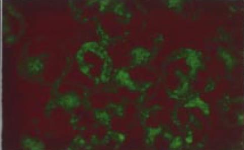monocytes C- PR3
