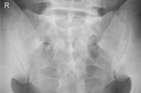 Case Vignette 35 -yr-old male Low back pain?