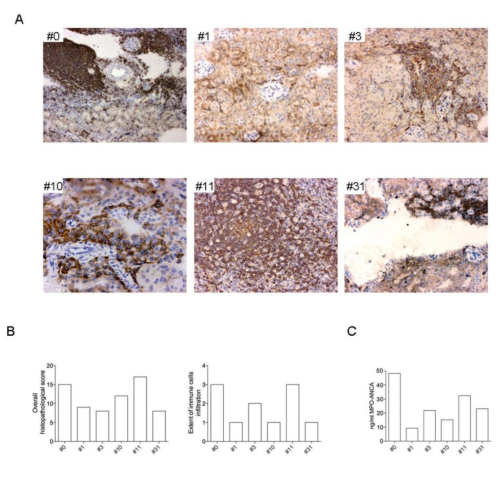 Supplementary Fig. 9 Correlation between perivascular neutrophils infiltration and development of ANCA in mice immunized with mdc co-cultured with NETotic PMN. A. Immunohistochemical analysis for Gr-1 expression in frozen renal sections from 6 individual mice.