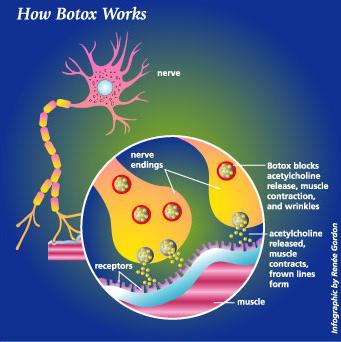Drawing of an axon at the neuromuscular junction. Where does Botox A work?