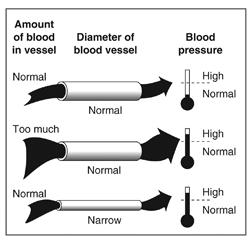 TheoreticalCauses of High Blood