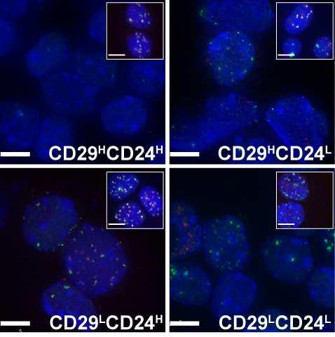 Altered DNA Damage Repair in CSCs s Altered DNA Damage Repair in CSCs IR t=0 IR t=48s Markers of