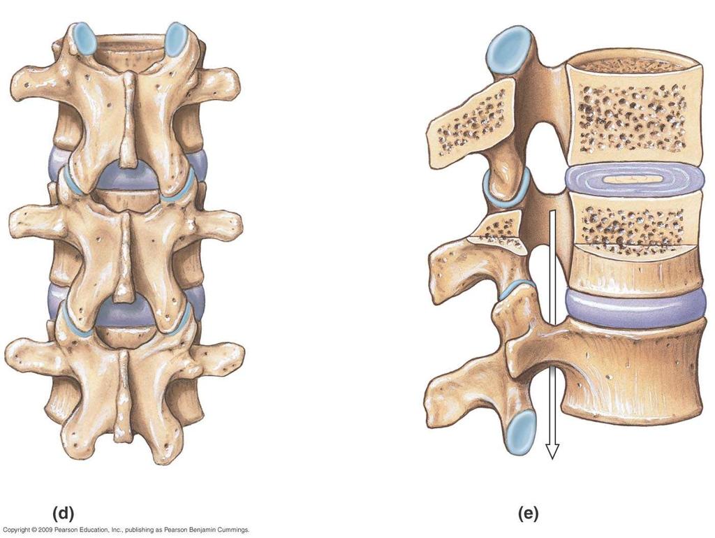 articular facet articular Lamina Intervertebral Intervertebral disc Spinous Intervertebral disc Transverse
