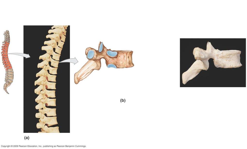 Typical thoracic vertebra Spinous of vertebra prominens C 7 T T 2 T 3 T 4 Transverse costal facet articular facet Pedicle Transverse es costal facet for head of rib articular body T 5 T 6 Spinous