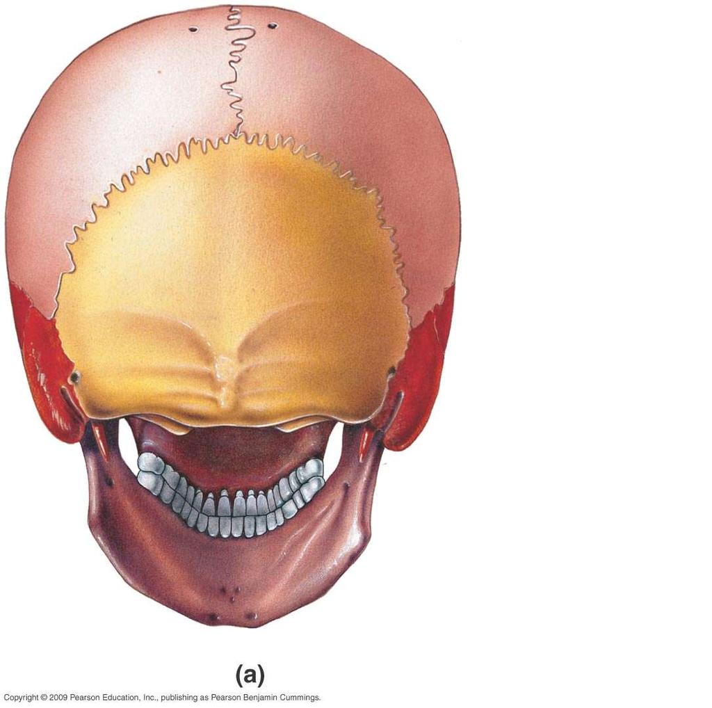 Left parietal Right parietal Sagittal suture Lambdoid suture Occipital