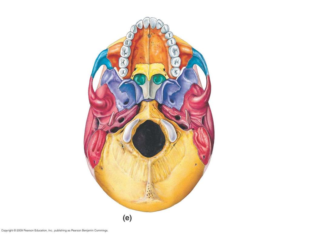 Frontal Zygomatic Vomer Sphenoid Foramen ovale (sphenoid ) Styloid (temporal ) Mandibular fossa (temporal ) External auditory (acoustic) meatus (temporal ) Jugular Maxilla Palatine