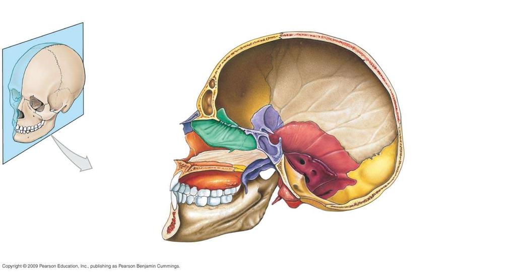 Coronal suture Frontal Sphenoid Sphenoidal sinus Frontal sinus Crista galli (ethmoid ) Nasal Perpendicular plate of ethmoid Vomer Mandible Maxilla Parietal Squamous suture Temporal