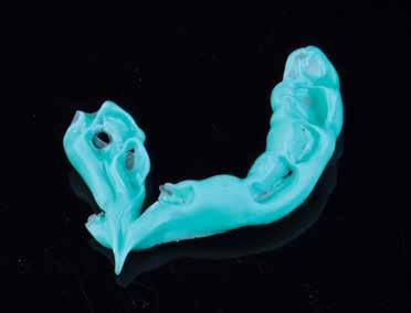 ideal, the tissue contours and interdental papillae had