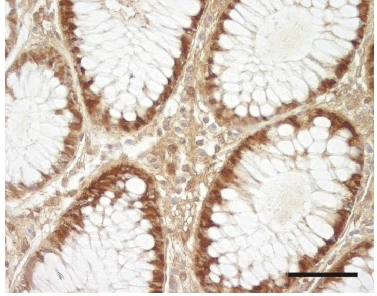 CA XII antibody stains basolateral membranes of pancreatic acinar cells and