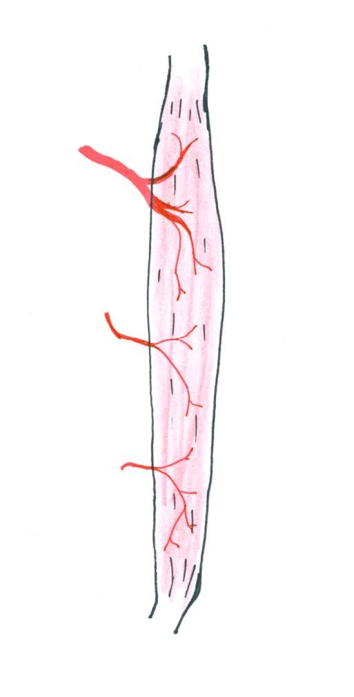 Musculocutaneous Flaps Mathes Classification Type II- one dominant vascular pedicle close to insertion with