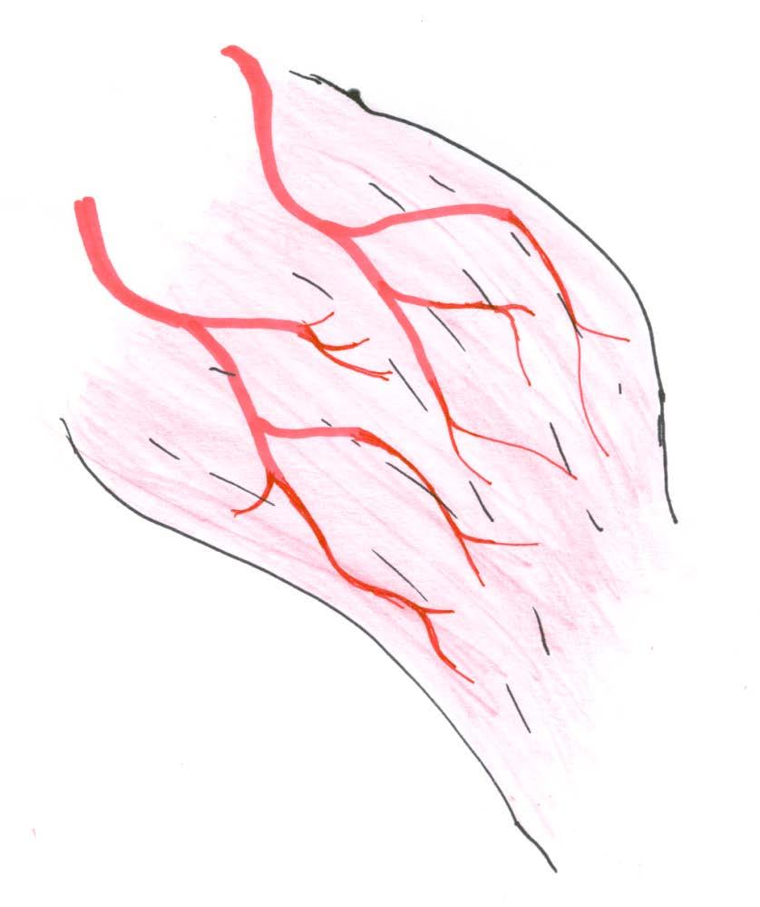 Musculocutaneous Flaps Mathes Classification Type III - two dominant