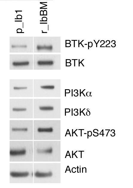 PI3K p PLCg2 Ibrutinib PKCb NFkB p p Akt Proliferation
