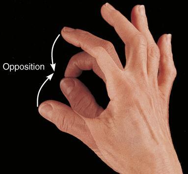 Ulnar Deviation Movement of the wrist towards the ulna or