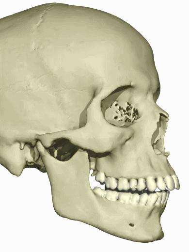 Head-Cephalic Skull Cranial Forehead--Frontal