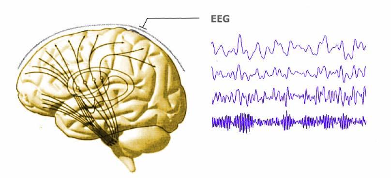 Electroencephalograhy (EEG) EEG: recording of the spontaneous natural electrical activity of active areas of the brain