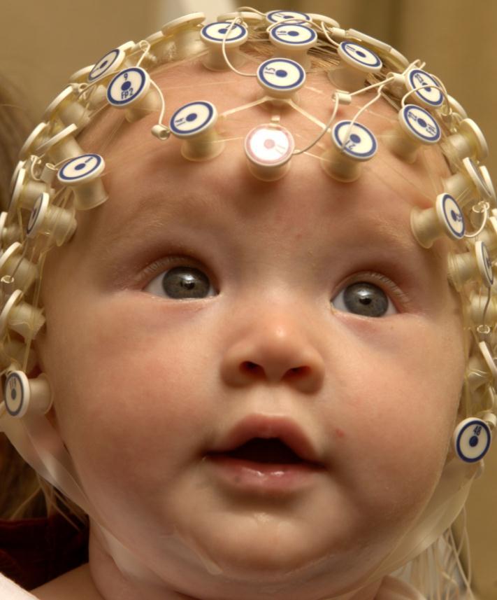 Cortical source analysis of infant spatial cueing International