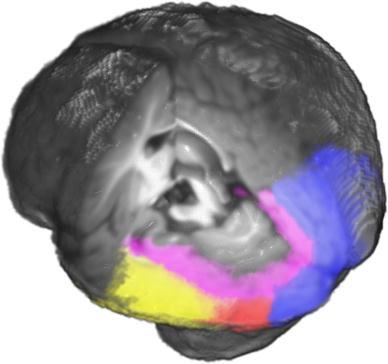 ROI s Derived from Stereotaxic Atlas Fusiform Gyrus