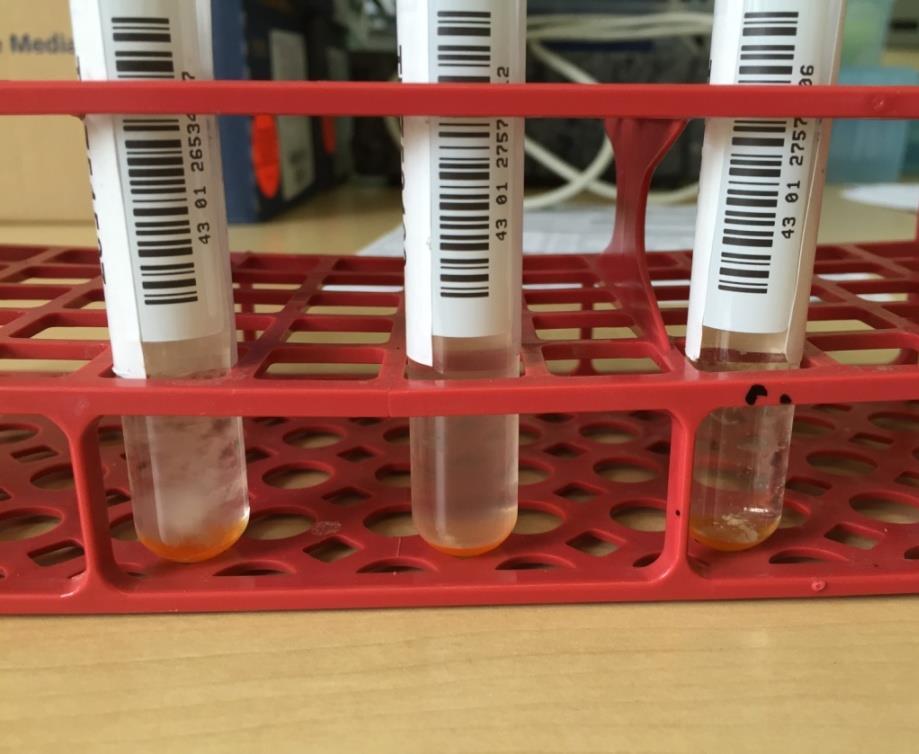Liquid culture 16 Contamination Rifampicin resistance cut-off 1μg/ml