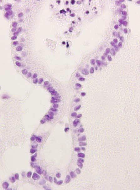 a: Immunostaining for smooth muscle actin (SMA; brown) demonstrates the presence of