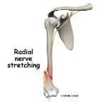 with fractures of the humerus), Radial tunnel