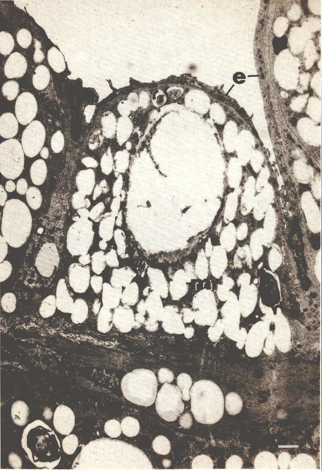 Tabas et al., Circulation, 2007 The Macrophage Foam Cell R.