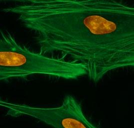 live or dead cells Image of HeLa cells labeled with nuclei stain Nuclear Blue DCS1 (Cat#17548, Blue).