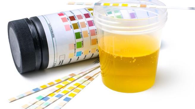 CURRENT TESTING FOR UTI Urinalysis Point of care Rapid automated
