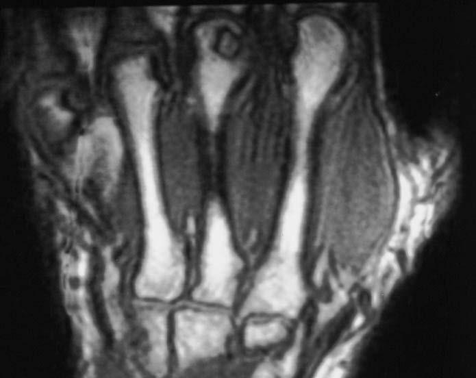 X-Ray Low-Field MRI