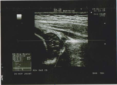 Picture 8 ultrasound control of