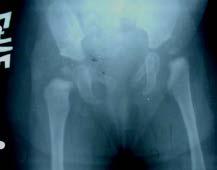 the patient s age and the condition of the hip assessed clinically and by imaging.