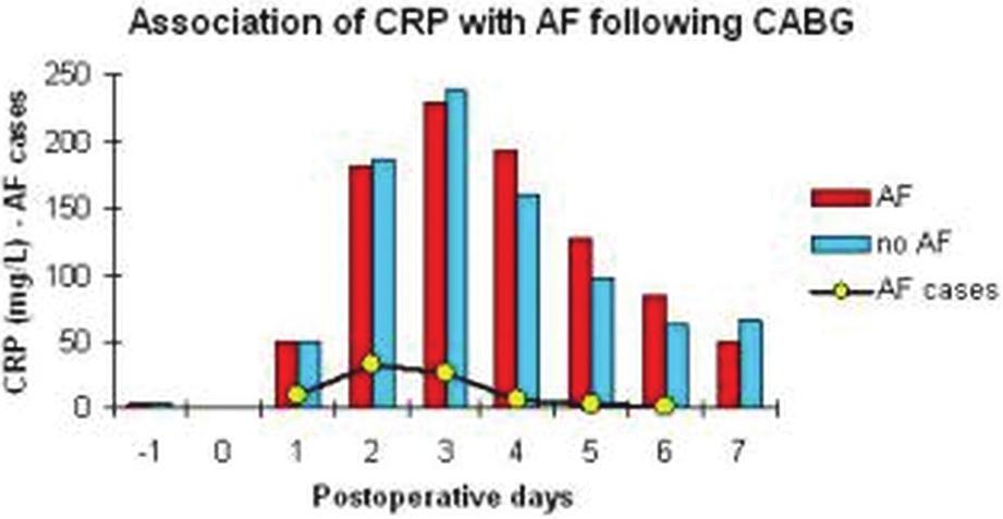 Coronary artery surgery: miscellaneous / Creating alternative image 323 P2069 Influence of on-pump versus off-pump cardiac surgery on completeness of revascularization in patients with stable