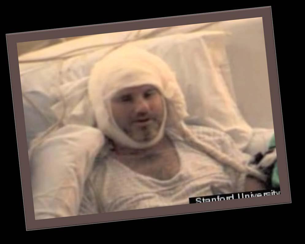 The patient sits on the bed, his head wrapped in thick gauze bandages.